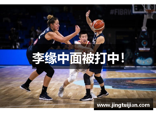 李缘中面被打中！